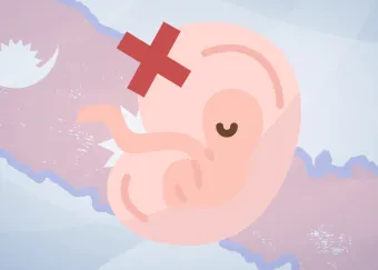 Abortion Laws in Nepal
